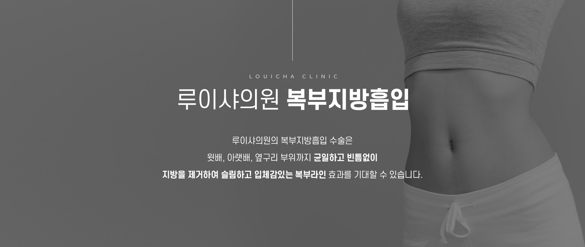 복부지방흡입 