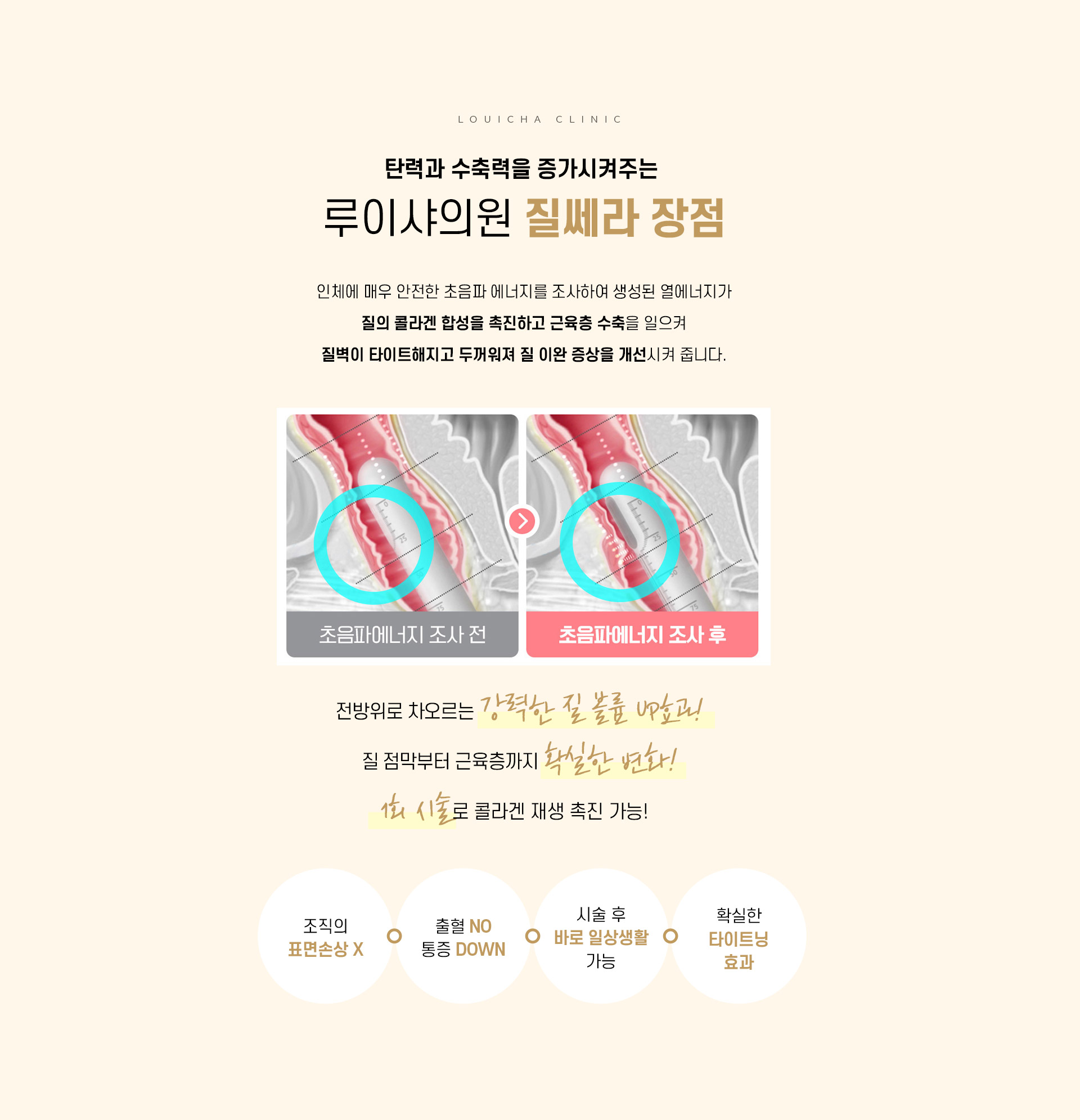 질쎄라 
