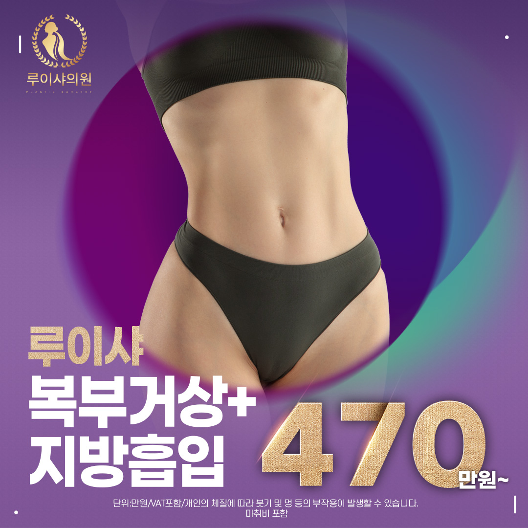 복부거상+지방흡입